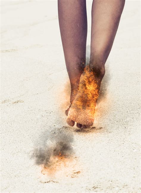 cks burning feet